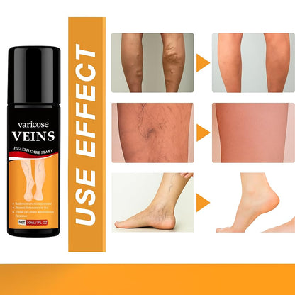 Turmeric Varicose Relief Herbal Spray (BUY 1 get 1 Free)🌿