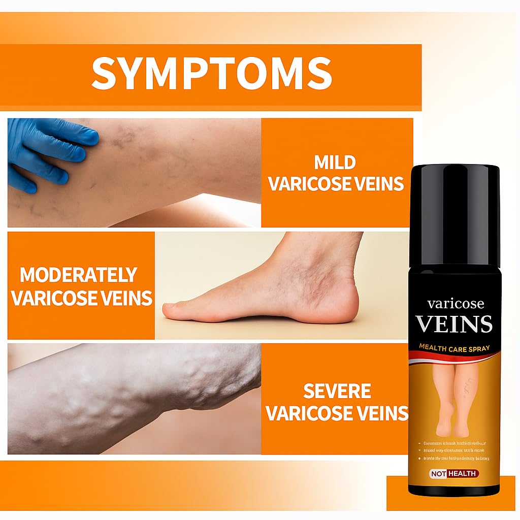 Turmeric Varicose Relief Herbal Spray (BUY 1 get 1 Free)🌿