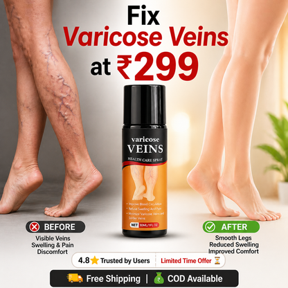 Turmeric Varicose Relief Herbal Spray (BUY 1 get 1 Free)🌿