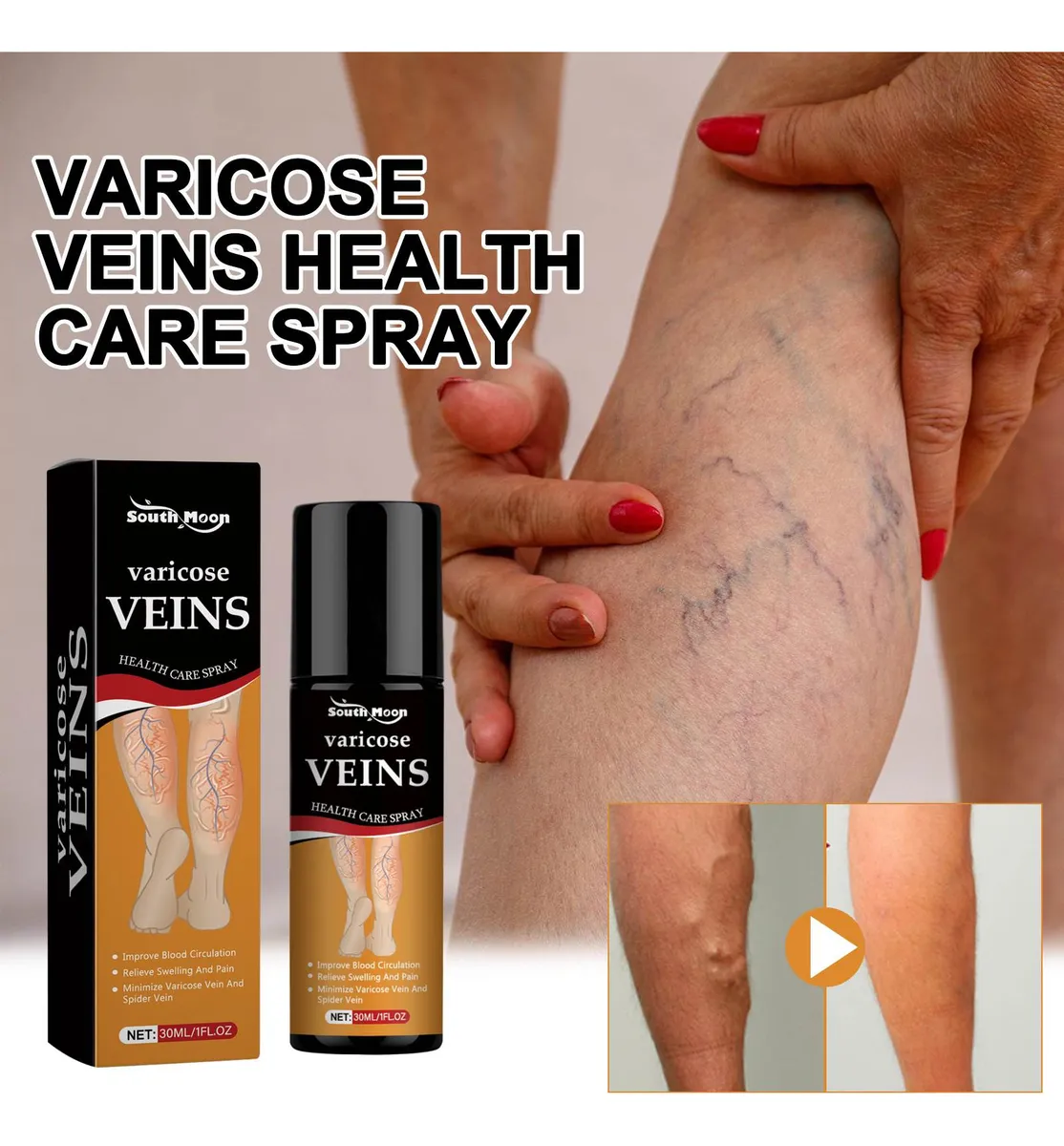 Turmeric Varicose Relief Herbal Spray (BUY 1 get 1 Free)🌿